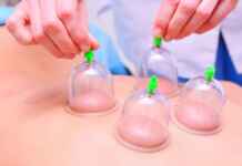 cupping and its benefits