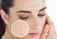 Ways to take care of dry skin in summers